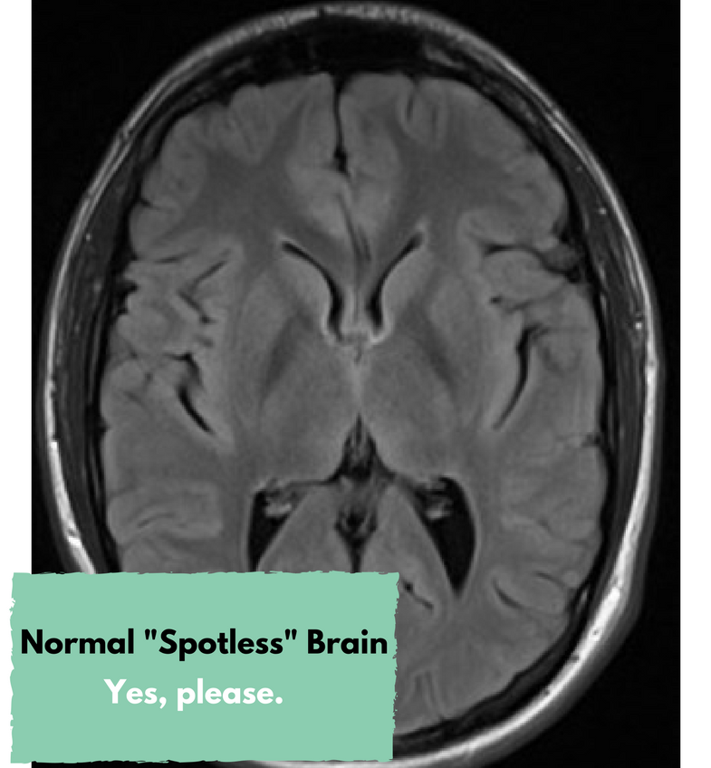 Normal -spotless-brain