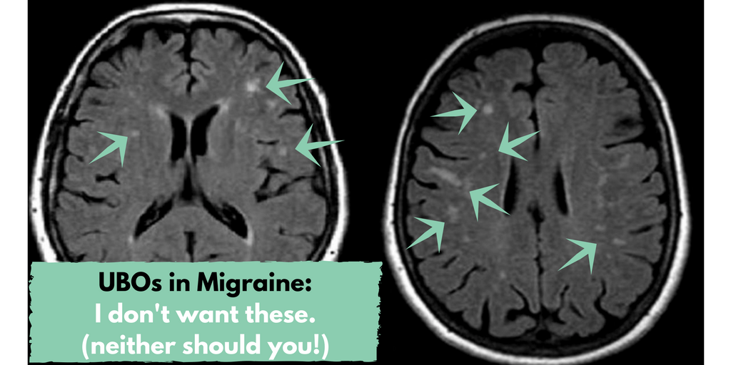 Scary spots in migraine brains