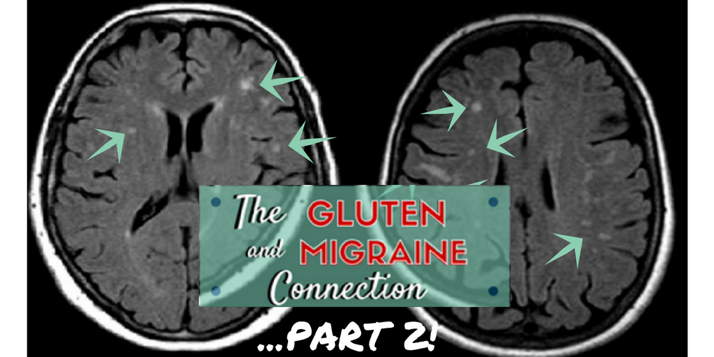 the gluten and migraine connection, part 2